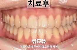 수술후