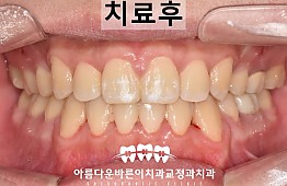 수술후