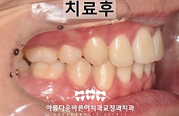 수술후