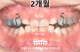 수술후