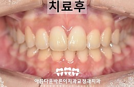 수술후