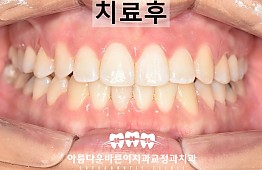 수술후