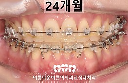 수술후