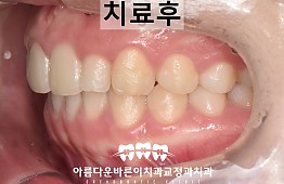 수술후