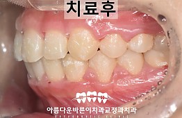 수술후