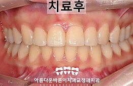 수술후