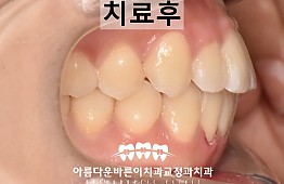 수술후