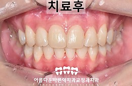 수술후