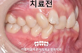 수술전