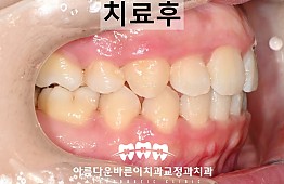 수술후