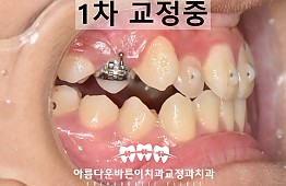 수술후