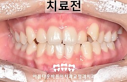 수술전