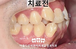 수술전