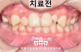 수술전