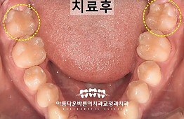 수술후