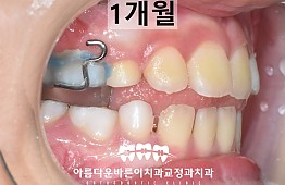 수술후