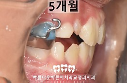 수술후