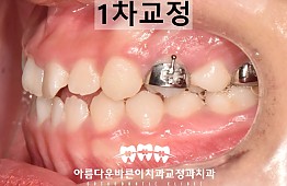 수술후