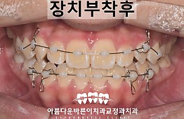 수술후