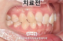 수술전