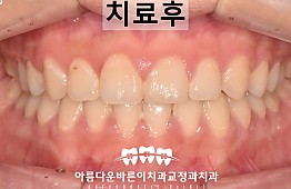 수술후