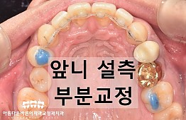 수술후