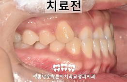 수술전