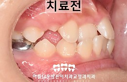 수술전