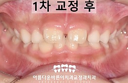 수술후