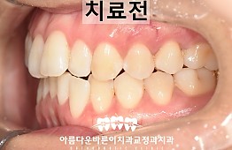 수술전