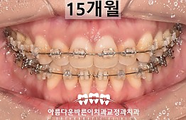 수술후