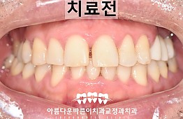 수술전