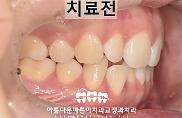 수술전