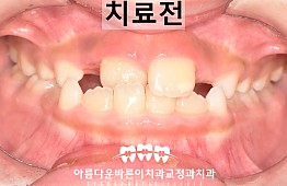 수술전