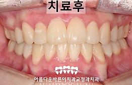 수술후