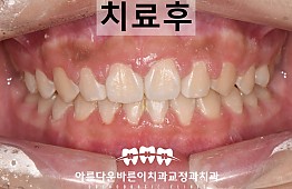 수술후