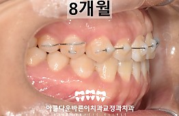 수술후