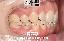 수술후