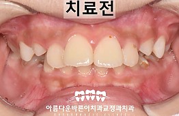 수술전