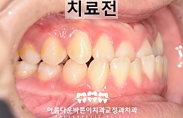 수술전