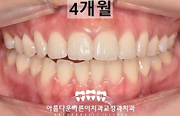 수술후