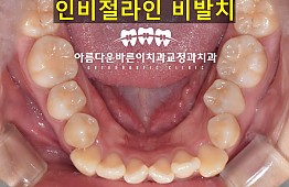 수술전