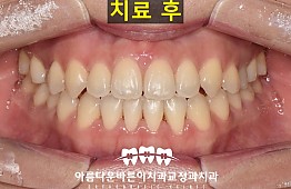 수술후