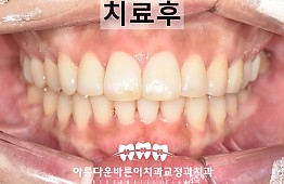 수술후