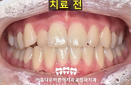 수술전