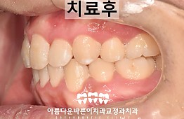 수술후