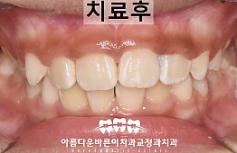 수술후