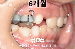 수술후