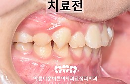 수술전