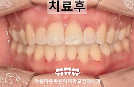 수술후